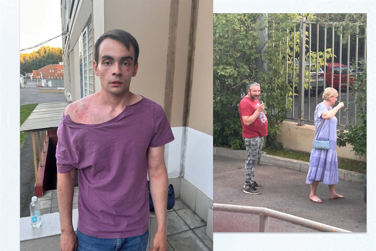 Александр, сборщик подписей, после нападения и напавшие на него мужчина и женщина. Фото: Глеб Бабич / Telegram